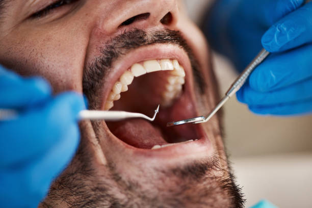 Best Emergency Treatment for Toothache in Cheree, OK